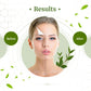 Epic Organic Platinum Formula Anti-Aging, Fine Line & Wrinkle Reducing Night Cream Epic Organic